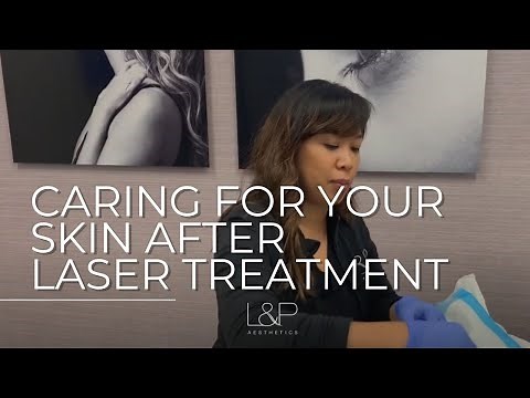 Caring For Your Skin After A Laser Treatment (TRL): L&P Aesthetics