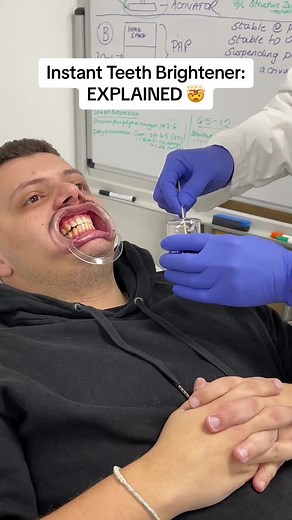 The teeth HACK explained 🤯 #edutok #revealed