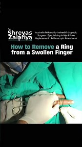How to Remove a Ring from a Swollen Finger