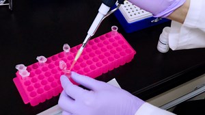 Quantitative Real-Time Polymerase Chain Reaction Evaluation of MicroRNA Expression in Kidney and Serum of Mice with Age-Dependent Renal Impairment