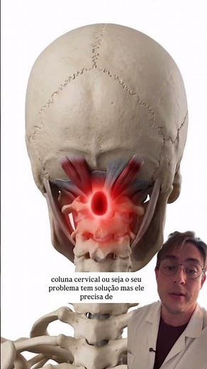 Dores de cabeça frequentes? Fisioterapeuta Osteopata explica como você pode viver sem limitações .