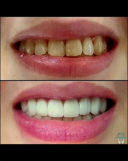 Customizing Smiles at FFGOMEZ DENTAL