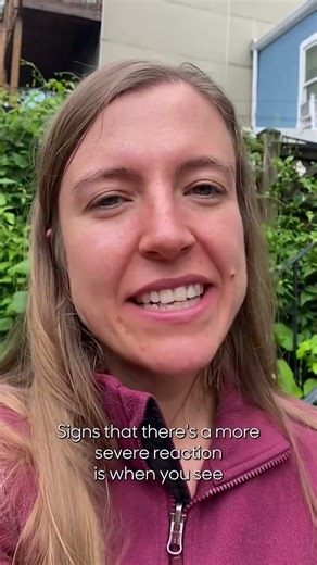 First Aid Basics: Allergic Reactions