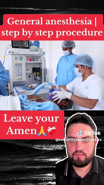 General anesthesia | step by step procedure