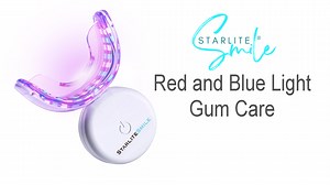 Starlite Smile Red & Blue Light Oral Care Device | Wireless LED Mouth Tray
