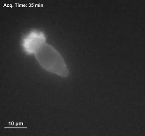 File:Filopodia-and-Membrane-Blebs-Drive-Efficient-Matrix-Invasion-of-Macrophages-Transformed-by-the-pone.0075577.s013.ogv - Wikimedia Commons