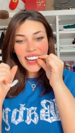 Understanding Snap On Smile: A Personal Demonstration