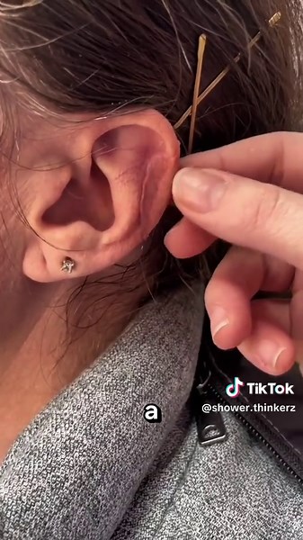 Creating Realistic Silicone Ears for Injuries