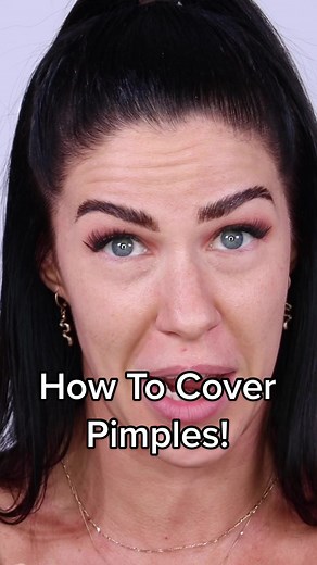Foolproof Ways to Cover Pimples All Day Long!
