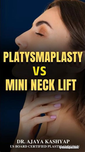 Platysmaplasty or MINI Neck Lift – Which Procedure Is Right for You? #necklift #shorts