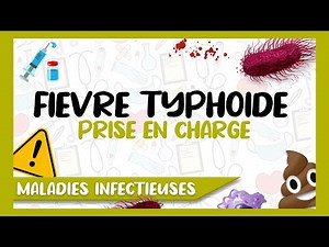 Typhoid Fever Management Explained Easily | What are the Means Available?