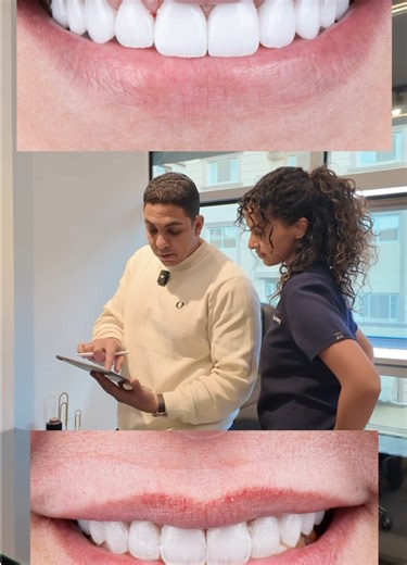 Choosing the Whitest Veneers: A Patient's Preference