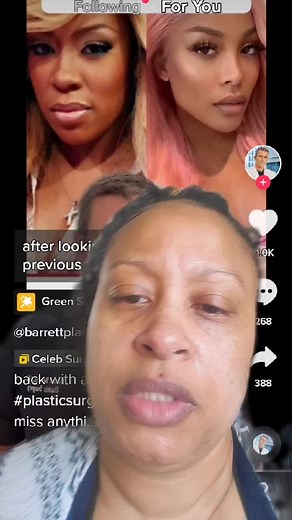 K Michelle Before and After Plastic Surgery Transformation