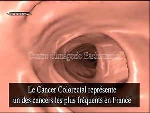 partie coloscopie virtuelle