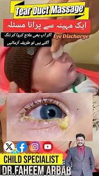 How to open nasolacrimal duct / tear duct obstruction | Solution of eye discharge with duct massage