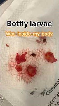 Botfly larvae which I got in Ecuador #botlfy #larvae #travel