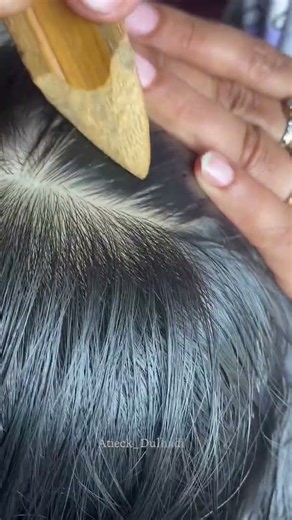 Crispy crackle sound #nits #lice #headlice #satisfying #hairextensions