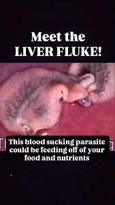 The liver fluke is a sneaky and dangerous parasite that hides in the liver, gallbladder, and bile ducts, feeding off your blood and nutrients , and even your iron.😬 Over time, this can lead to: Low ferritin, even with supplements 💤 Chronic fatigue and brain fog Shortness of breath Cold hands and feet Persistent anemia What most people miss? You can eat all the right foods and take all the right supplements, but if parasites like flukes are stealing your minerals before your body can absorb the
