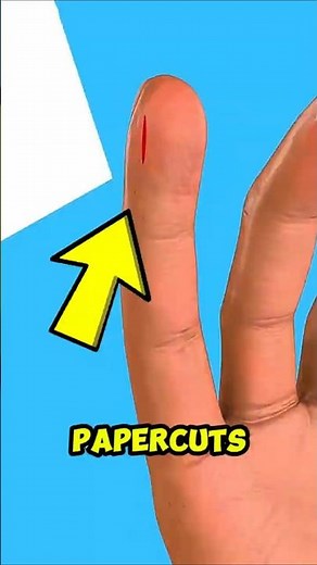 Stop Paper Cut Pain FAST! (Don't Make This Common Mistake) 😱‼️