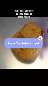 Real Human Heart Anatomy Explained | Heartstrings & Emotions