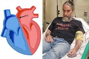 Scott McPartland Stroke - May 18th, 2022