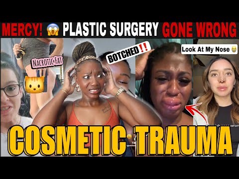 PLASTIC SURGERY GONE WRONG! Botched BBL, Fillers & Cosmetic Trauma Horror Stories | TikTok REACTION