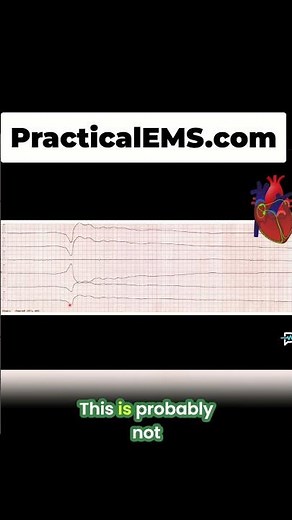 Asystole: The Flatline! Learn the Last Dysrhythmia in Seconds! #shorts