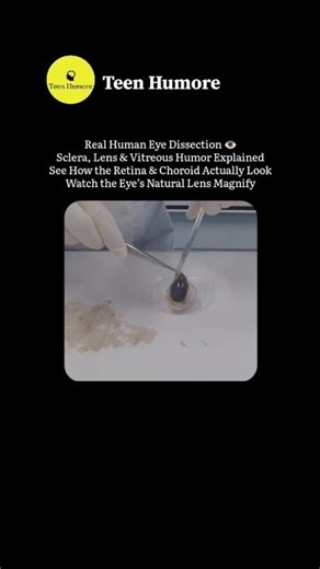 Real Human Eye Dissection 👁️ | Sclera, Lens, Retina Explained (Anatomy Breakdown)