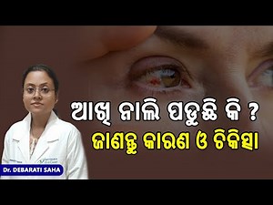 Why Is Your Eye Red? Causes, Symptoms & Treatment Explained by Dr. Debarati Saha