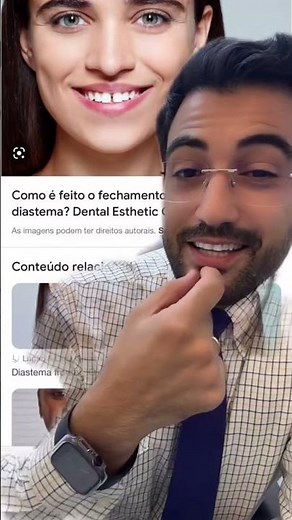 3 WAYS TO CLOSE A DIASTEMA