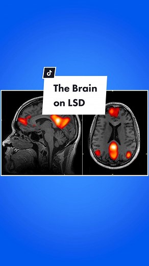 Reply to @cupidtruffleshuffle How does LSD affect the human brain? #fyp #foryou #foryoupage #science #sciencefacts #edutok