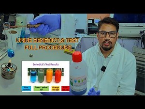 BENEDICT TEST Procedure to analyze sugar in urine | Manual Sugar Test by urine | AK Biology