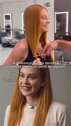 Dra Aylla Suriann |Harmonização Facial | Estética Regenerativa on Instagram: "✨ Você já reparou como os lábios e o sorriso mudam completamente a harmonia do rosto? Na série Tremembé, a transformação da Marina Ruy Barbosa chamou atenção — não apenas pelo visual, mas pelo equilíbrio facial que o sorriso trouxe. 🪞Os lábios têm papel fundamental na proporção e no equilíbrio global da face. Eles moldam o contorno, realçam a expressão e influenciam diretamente a percepção de beleza natural. 💋 Cuidar