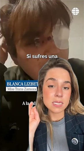 🔴 What to do if I have been assaulted? 🔴