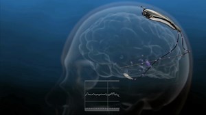 CyborgRx: How Smart Implants Could Change Medicine