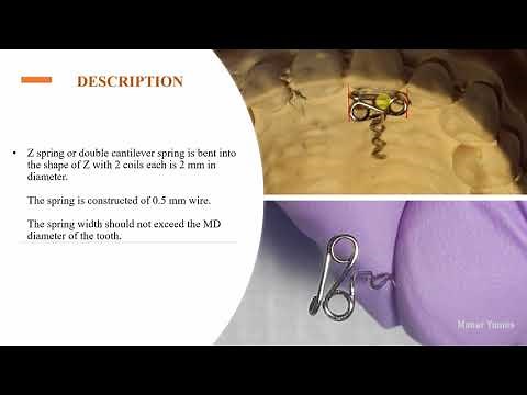orthodontic lab- Z spring
