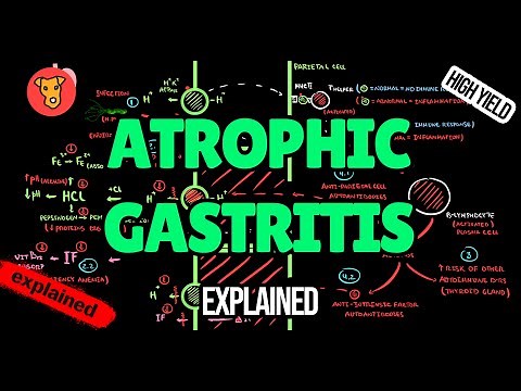 Atrophic Gastritis EXPLAINED: Pathogenesis, Diagnosis & Treatment (USMLE High-Yield)