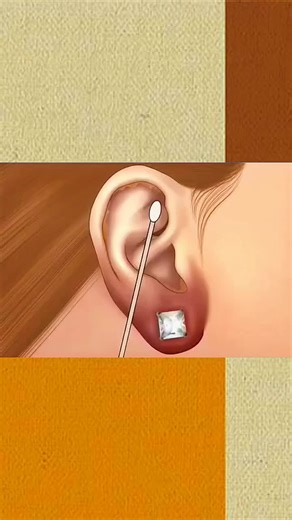Effective Ear Cleaning and Treatment ASMR Animation