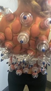 🏆 Cupping uses gentle suction to lift the skin and fascia, helping release deep muscle tension, improve circulation, and support faster recovery. Great for sore shoulders, stiff backs, and post-workout tightness. 🏋🏽‍♂️🏌🏿‍♀️🏃🏻‍♀️#CuppingTherapy #FascialRelease #MuscleRelief #RecoveryTools #ChicagoChiropractor #DrKyleRoss | Dr_kyleross