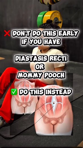 Amrutha | Fitness Coach on Instagram: "DON’T DO THIS. ❌ Why some exercises are not recommended early (DR / postpartum / mommy pooch) 1️⃣ The abdominal wall is stretched During pregnancy, the linea alba becomes lengthened and weaker. Early high-intensity ab exercises can overload this tissue before it’s ready. 2️⃣ Too much internal pressure Crunches, planks, leg raises, mountain climbers and twisting create high intra-abdominal pressure. If the core can’t manage it yet, pressure pushes outward → 