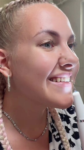 #ad|@Bshopy.hu Ultrahangos Fogtisztító Készülék 🤩 Használjátok az AGICA10 kódot vásárlás végén 10% kedvezményért ✨ 🎁 #dental #bshopy #electric