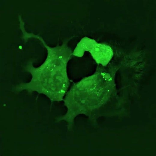 Human cells under microscope | time-lapse