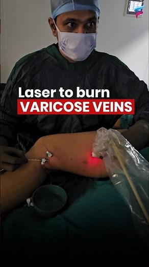 What Happens When LASER Hits Your Blood Vessels?