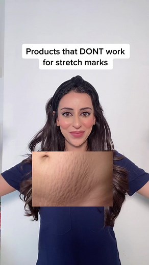 Save your 💰 🙅🏽‍♀️ #dermatologist #dermatologydoctor #stretchmarks #scars #skintok #stretchmarkremoval #cocoabutter #skintips #skinhacks #skincareroutine #learnontiktok #fypシ #foryou #foryou