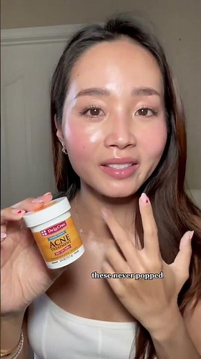 De La Cruz Acne Treatment for Clear Skin! #sulfur #acnetreatment #cysticacne