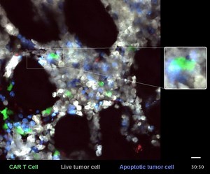 6.2K views · 186 reactions | Intravital two-photon imaging of the bone marrow of a mouse with B cell lymphoma shows a CAR T cell (green) come into contact with a live tumor cell (gray) and quickly killing it (causing it to turn blue). Cazaux et al. 2019 in JEM https://bit.ly/2COyrEh | Journal of Experimental Medicine | Facebook