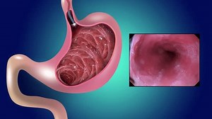 2d Animation Gastric Mucosa Digestive Endoscopy Stock Footage Video (100% Royalty-free) 3582171883 | Shutterstock