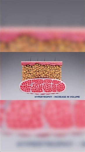 EMS Body Shaping System for Professional Use