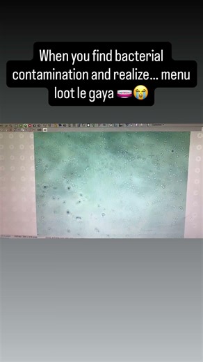 When you find bacterial contamination & realize menu loot le gya #research #bacteria #memes #viral