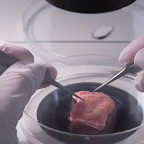 Video: The Isolation and Culture of Primary Epicardial Cells Derived from Human Adult and Fetal Heart Specimens